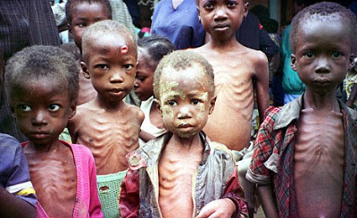 Malnutrition is responsible for most deaths in Nigeria IDP camps