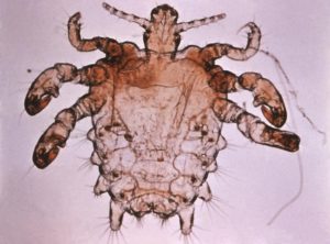 crabs (pubic lice) in africa