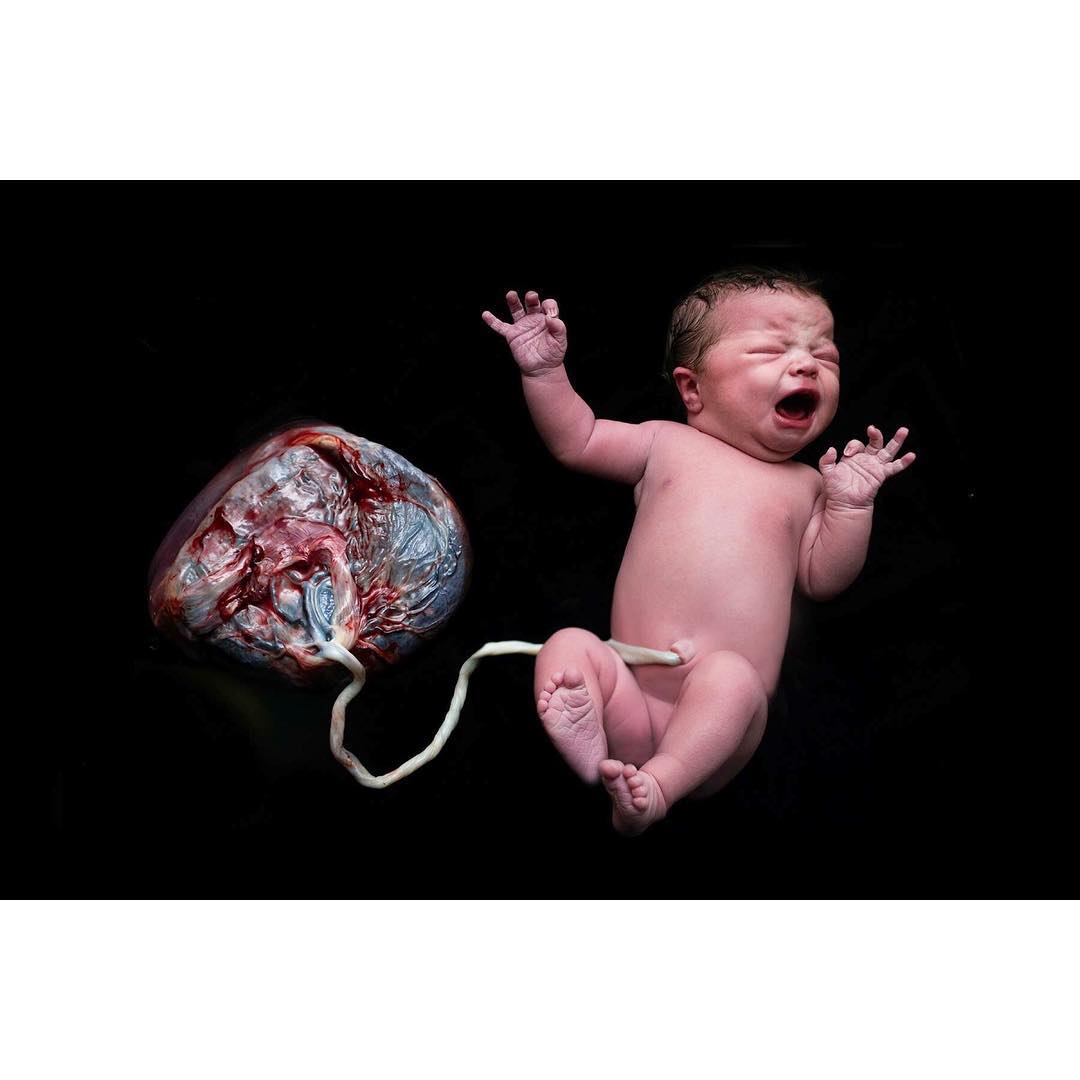 Baby with placenta intact