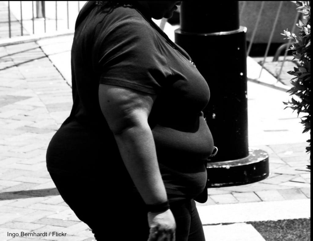 10 Facts About Obesity You Should Know