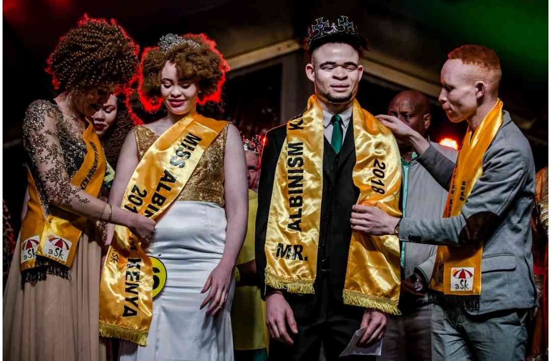 First Ever Mr and Miss Albinism East Africa