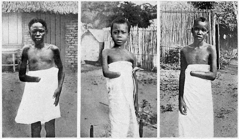 Victims of King Leopold 