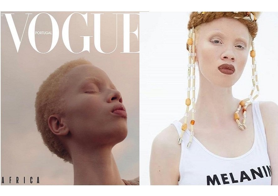 30-Year-Old South African Lawyer Becomes First Model With Albinism to ...