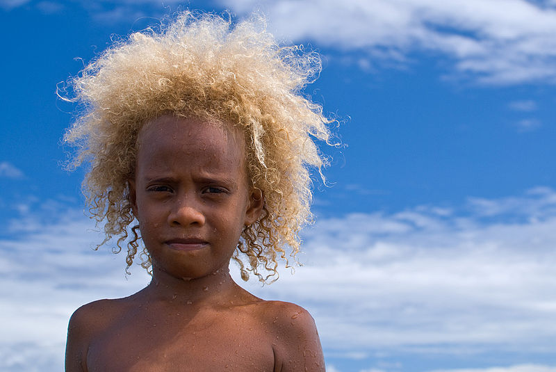 Melanesians: Meet The World’s Only Black Blond Population