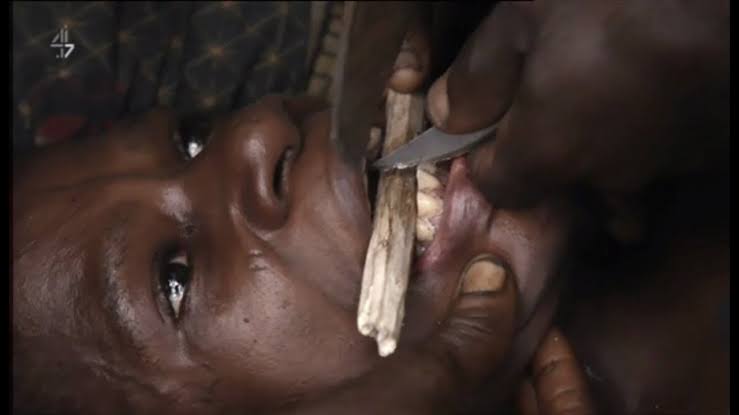 Teeth Sharpening Cultural Body Modification in Africa